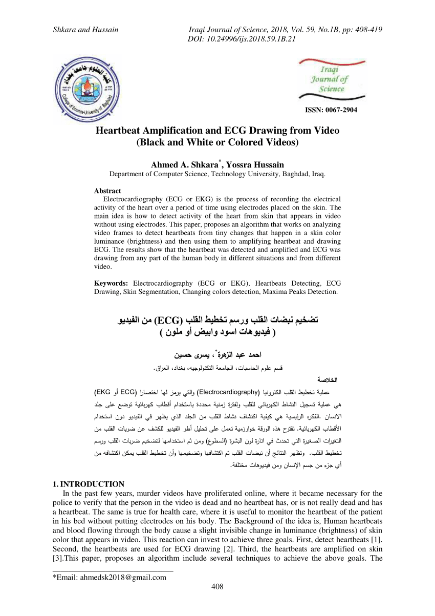 850x1203 pdf heartbeat amplification and ecg drawing from video - Ekg Drawing