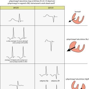 300x300 photostock vector drawing of the heart electrical conduction - Ekg Drawing