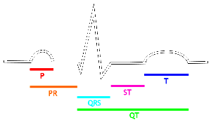 300x171 the ekg electrocardiogram - Ekg Drawing
