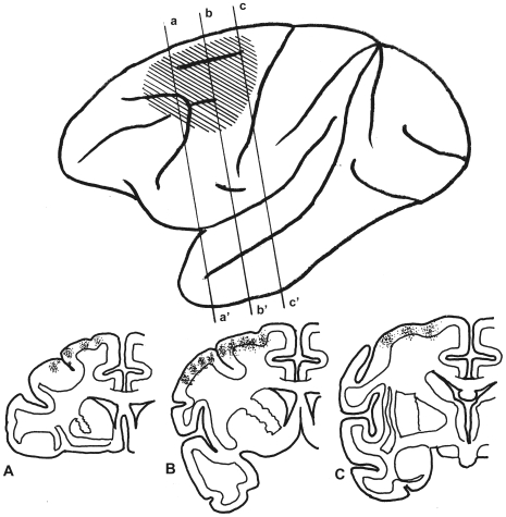 465x475 upper drawing shows the expansion of the injected wga hrp solution - Expansion Drawing