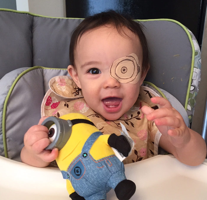 700x677 This Girl Has To Wear An Eyepatch, So Her Dad Tries To Make - Eye Patch Drawing