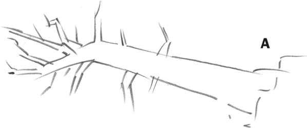 598x251 Dead Fallen Trees - Fall Tree Drawing