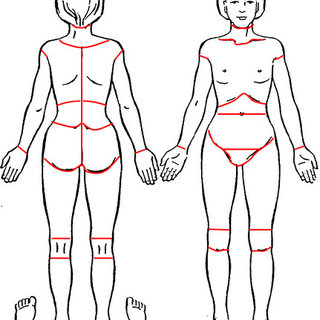 320x320 Pain Drawing Of A Female Body The Pain Location Area Borders Were - Female Body Drawing