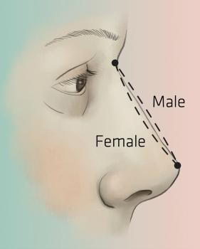 281x350 ffs nose feminization reshaping procedure rhinoplasty surgery - Female Nose Drawing