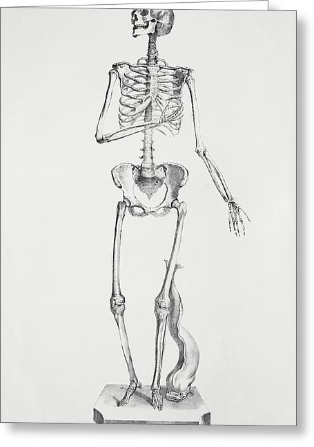 455x646 Female Skeleton Photograph - Female Skeleton Drawing