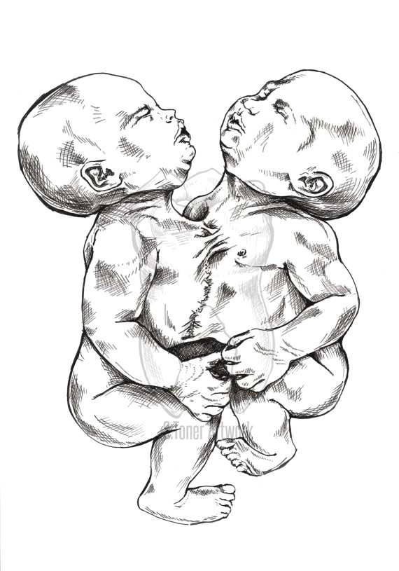 570x815 fetus drawing twin baby for free download - Fetus Drawing