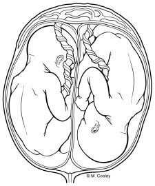 225x270 fetus line drawing - Fetus Drawing