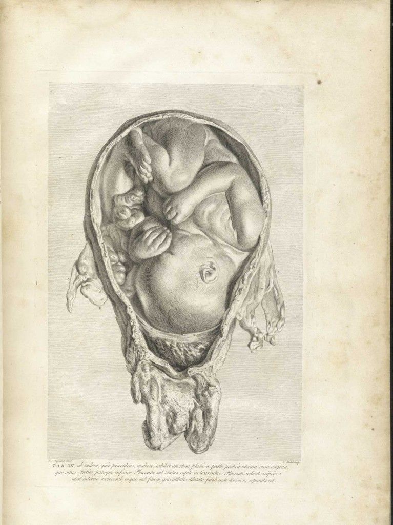 767x1024 Drawing Of The Human Fetus In Utero From Da Vinci's Anatomical - Fetus In Womb Drawing