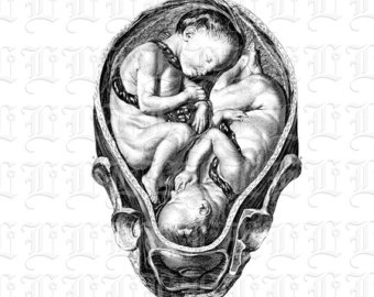 340x270 Human Fetus Baby Womb Vintage Illustration Digital Image High Etsy - Fetus In Womb Drawing