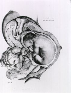 236x307 Best Baby In Womb Images Pregnancy, Pregnancy Art, Drawings - Fetus In Womb Drawing