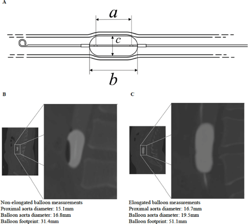 850x769 A Line Drawing Of An Er Reboa Catheter Length 'a' Is - Footprint Line Drawing