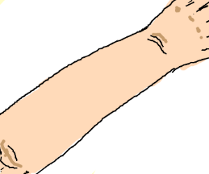 300x250 Forearm Drawing - Forearm Drawing