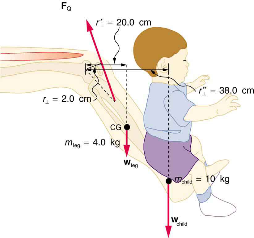822x768 forces and torques in muscles and joints college physics - Friction In A Bone Joint Vector Drawing