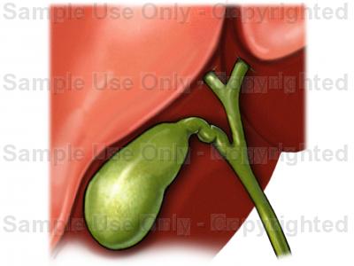 400x300 Gallbladder, Anterior View - Gallbladder Drawing