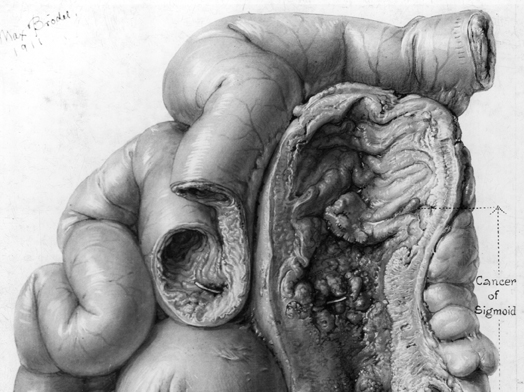 524x392 Grayscale Revealed - Grayscale Drawing