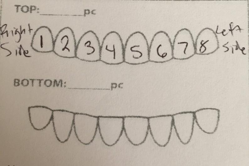794x529 Missing Teeth Or Chipped Teeth For Grillz Listing For Custom Etsy - Grillz Drawing