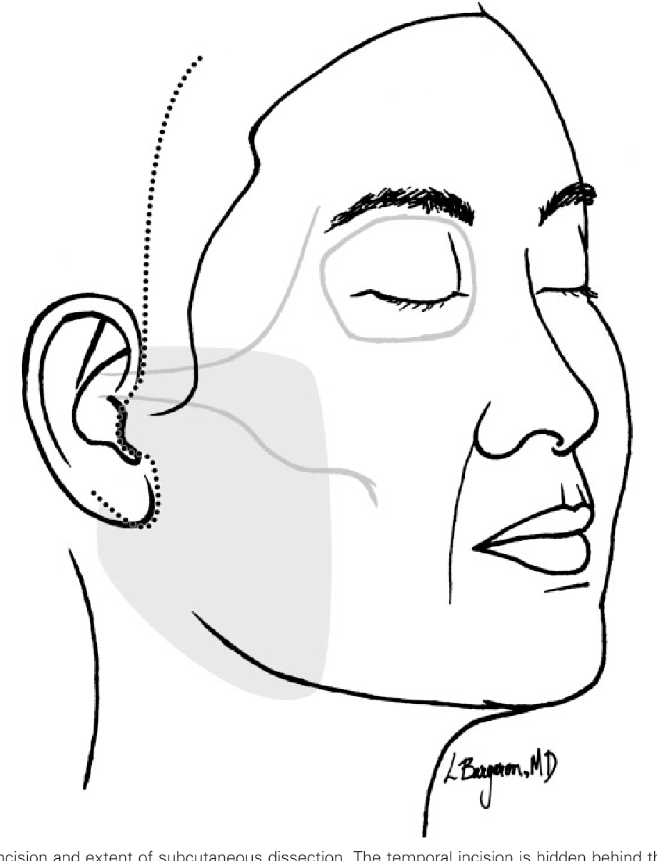 920x1206 drawing hairline ear for free download - Hairline Drawing