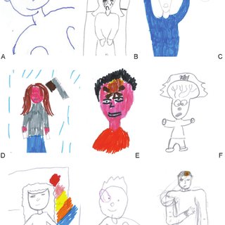 320x320 Pdf Children's Headache Drawings In The Diagnostic Work Up - Headache Drawing