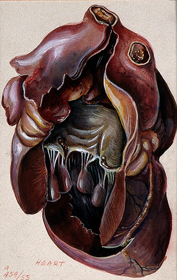 350x554 Heart Disease In The First World War - Heart Disease Drawing