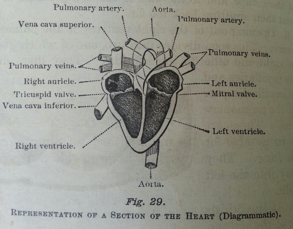1212x947 Patients Counseled On Genetic Heart Disease Risk Feel They Have - Heart Disease Drawing