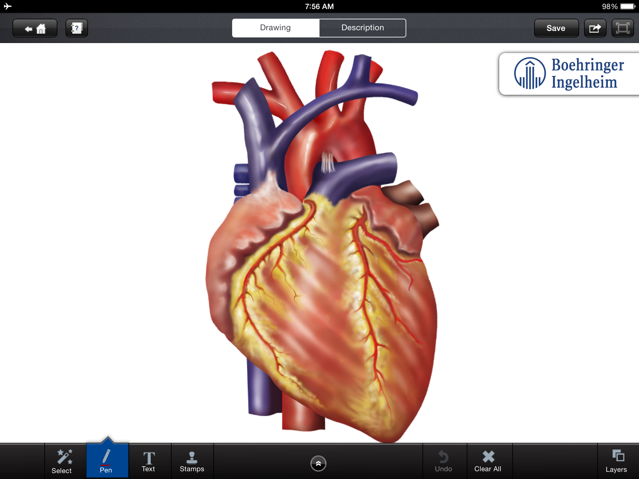 2048x1536 Three Best Apps For Discussing Heart Disease With Your Patients - Heart Disease Drawing