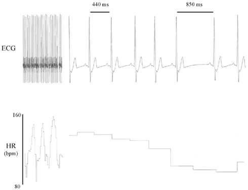 490x376 Heart Rate Variability - Heart Monitor Drawing