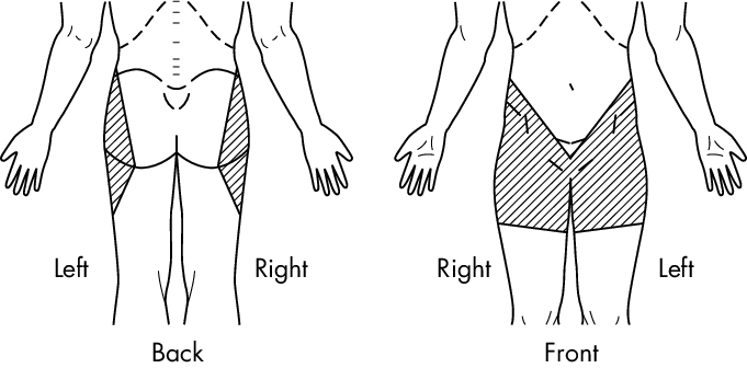 681x336 Hip Pain Drawing Download Scientific Diagram - Hip Drawing