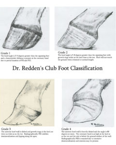 240x300 hoof irregularities club foot - Horse Hoof Drawing