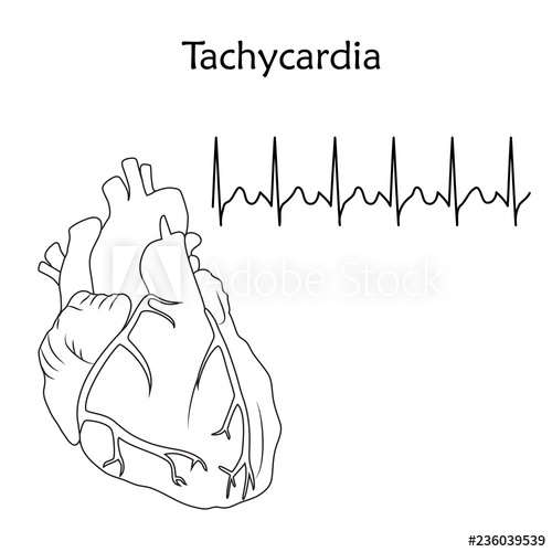 500x500 Human Heart Tachycardia Anatomy Flat Illustration Outline Image - Human Heart Drawing Outline