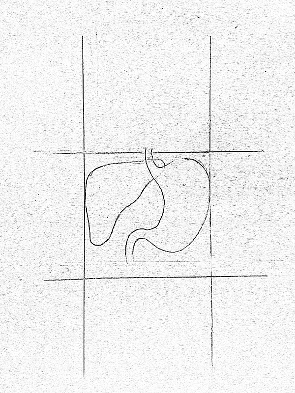 600x800 liver drawing free download - Human Liver Drawing