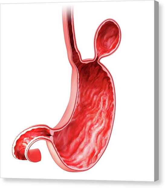 546x622 human stomach with hernia photograph - Human Stomach Drawing