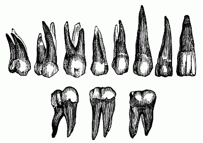 400x283 Realistic Drawing Of The Various Forms Of Human Teeth - Human Teeth Drawing