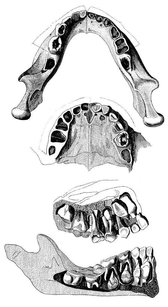 570x1039 the human skull, jaw, teeth, old medical atlas illustration - Human Teeth Drawing