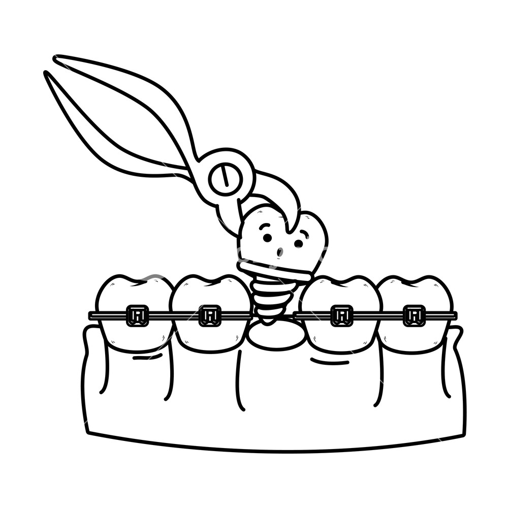 1000x1000 human teeth with pliers extracting implant vector illustration - Human Teeth Drawing