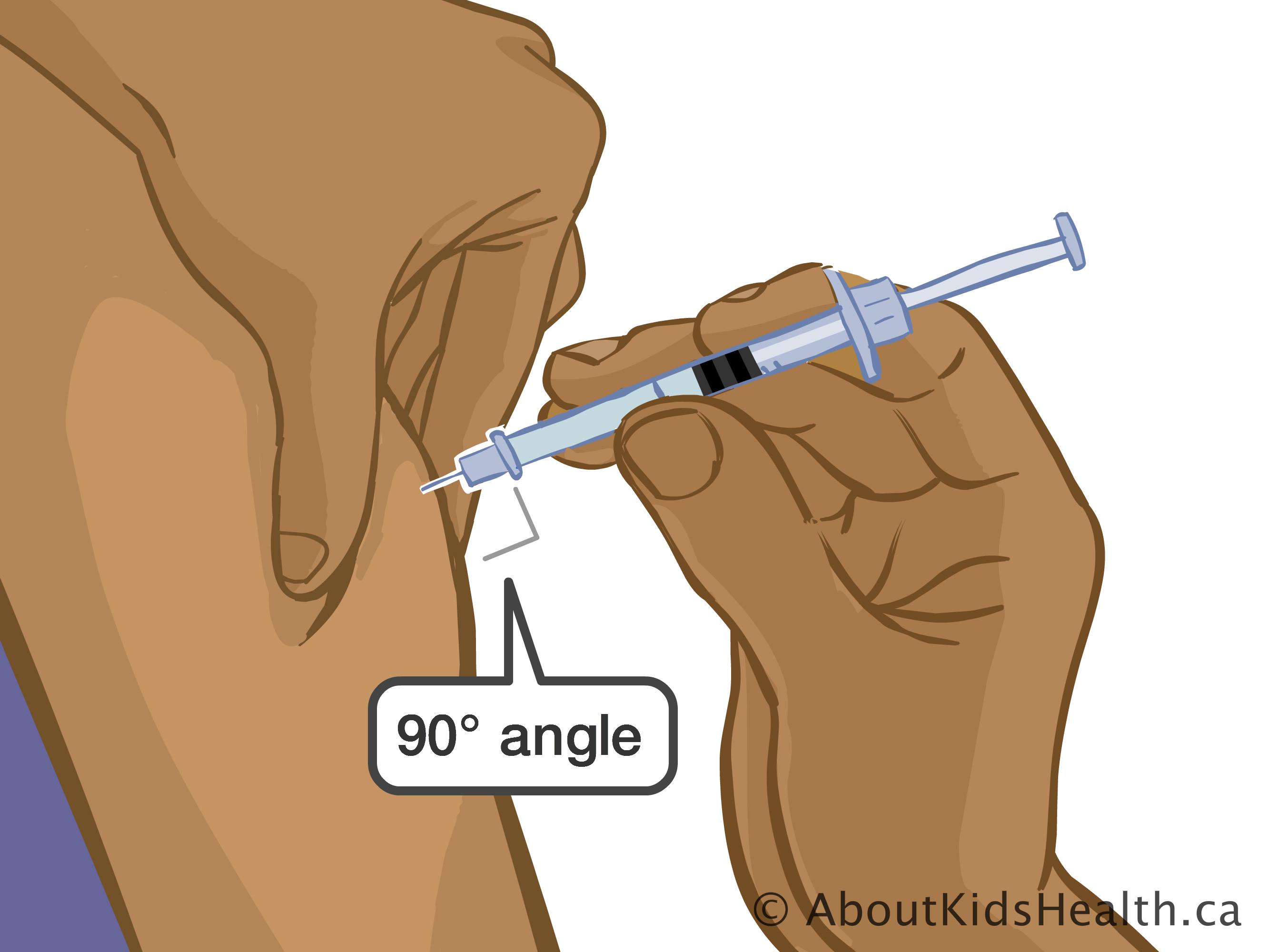 2664x2000 Enoxaparin Injecting - Injection Drawing
