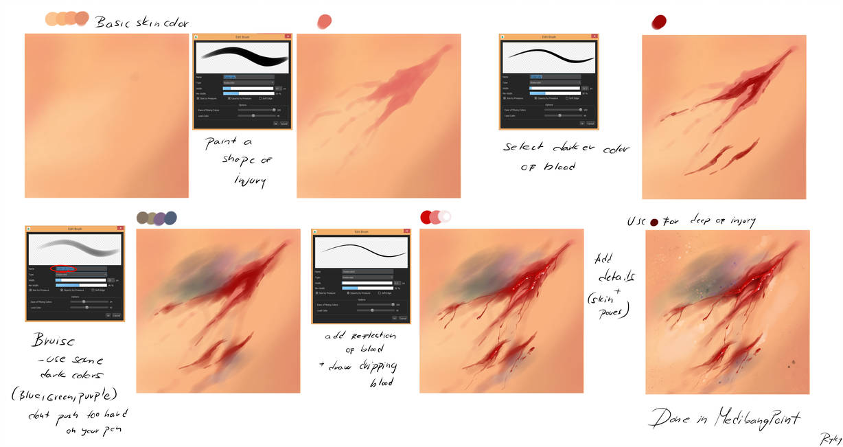 1228x651 injury - Injury Drawing