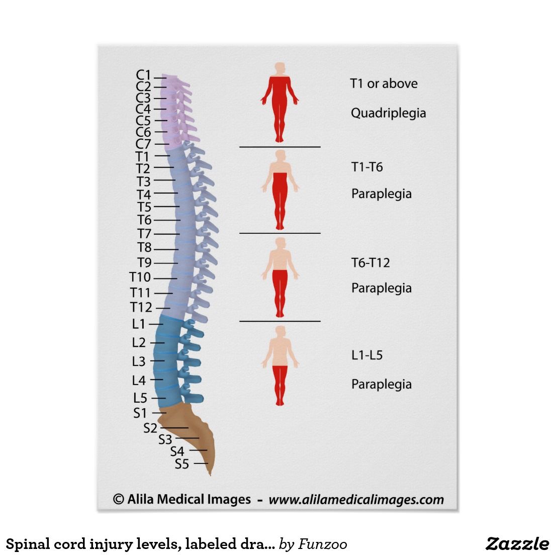 1104x1104 spinal cord injury levels, labeled drawing poster - Injury Drawing