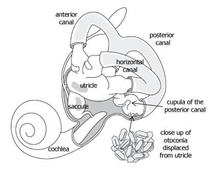414x336 Inner Ear Crystals And Bppv - Inner Ear Drawing