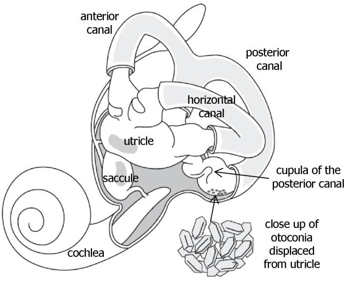 681x549 Benign Paroxysmal Positional Vertigo - Inner Ear Drawing