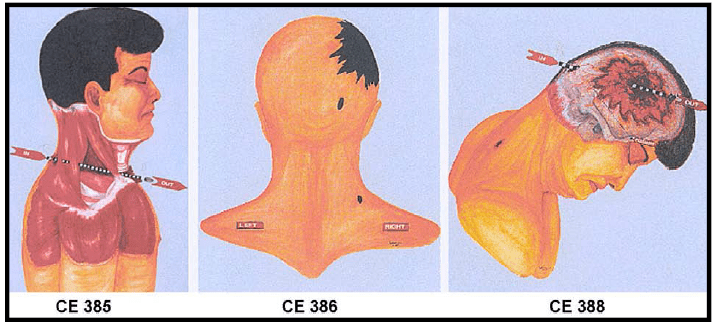 717x324 the remarkable story of skip rydberg - Jfk Drawing