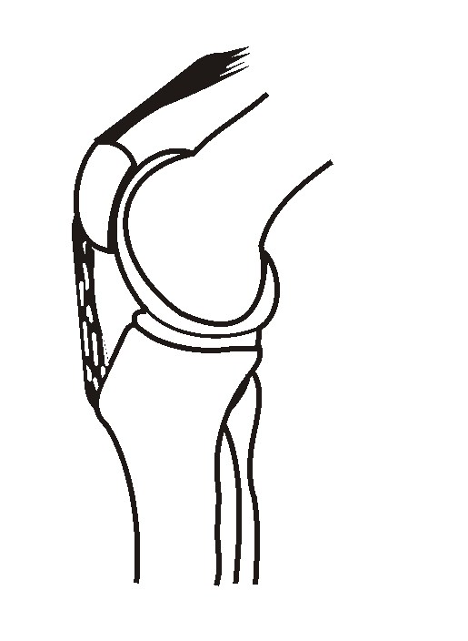 Рисунок коленного сустава