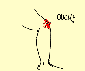 300x250 Scraped Knee Drawing - Knee Drawing