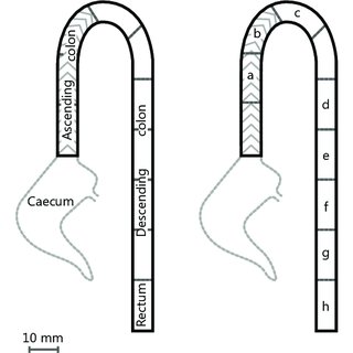 320x320 Mapping The Segments Of The Large Intestine - Large Intestine Drawing