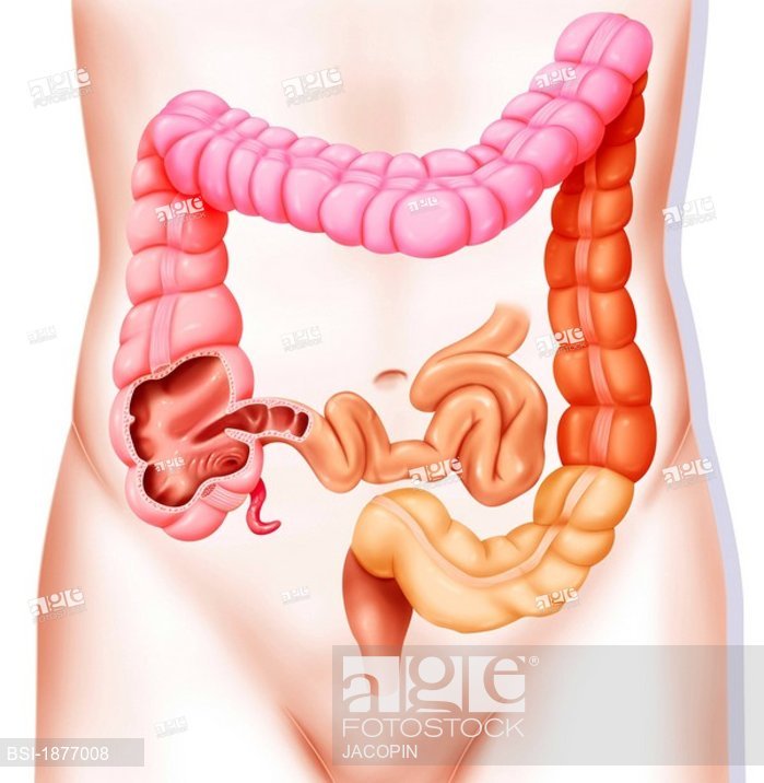 699x716 Colon, Drawing Colon And Large Intestine, Stock Photo, Picture - Large Intestine Drawing
