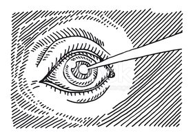 280x200 eye laser surgery drawing stock vectors - Laser Drawing