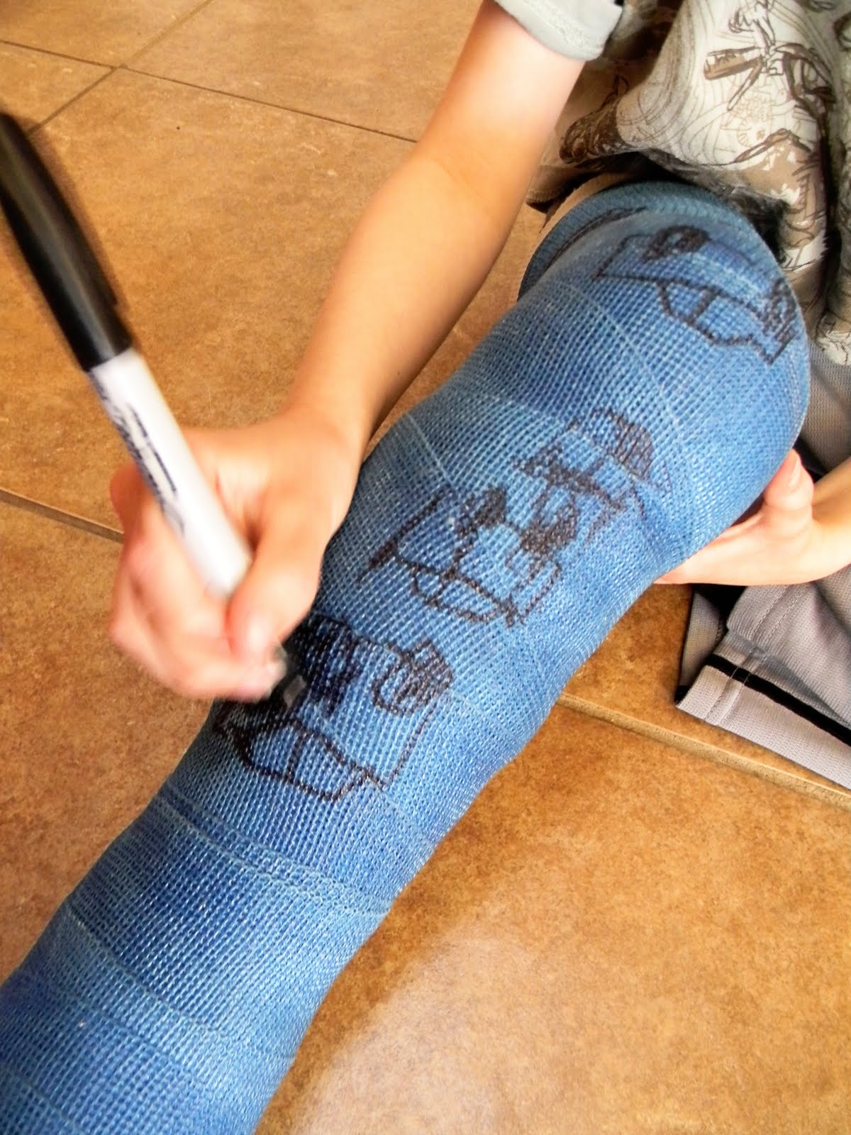1200x1600 home kids life a kid in a leg cast - Leg Cast Drawing