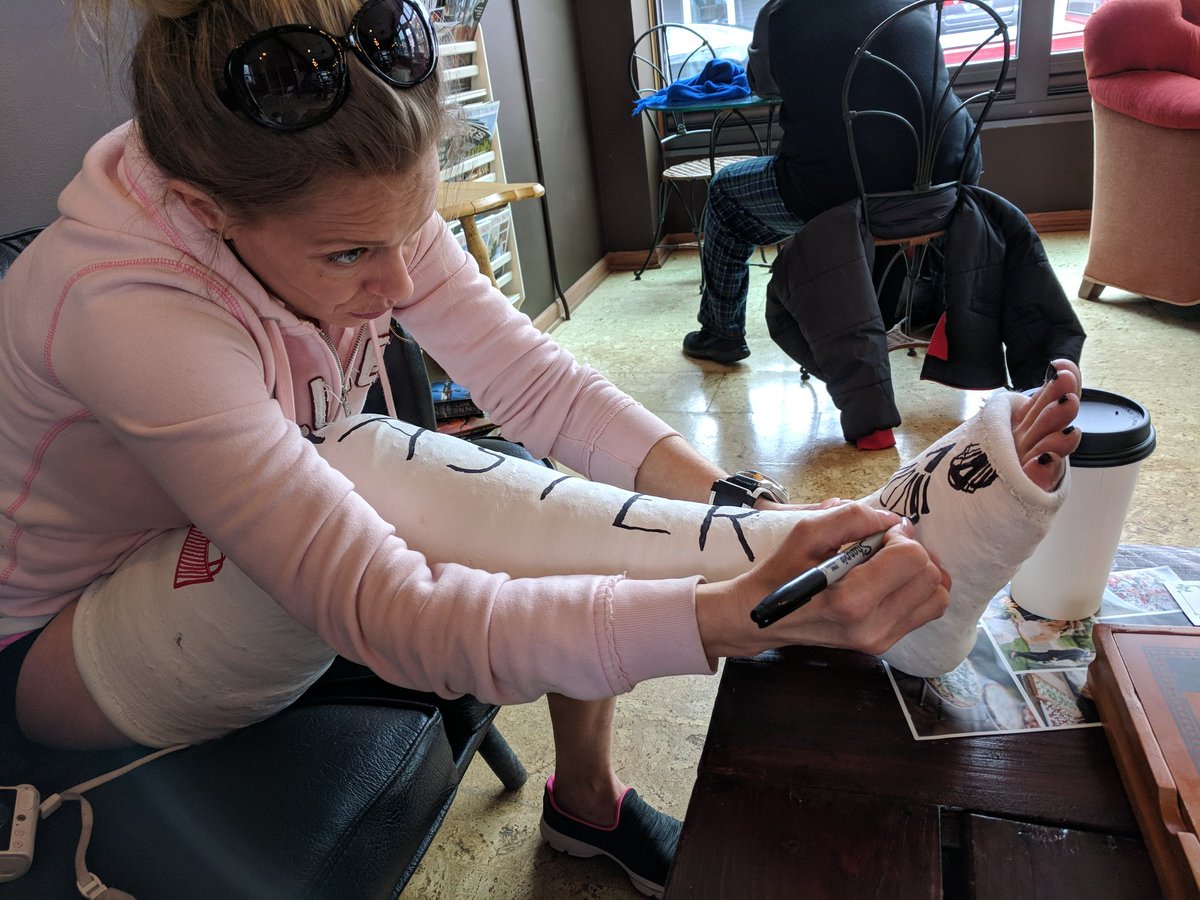 1200x900 Kevin Casters On Twitter - Leg Cast Drawing