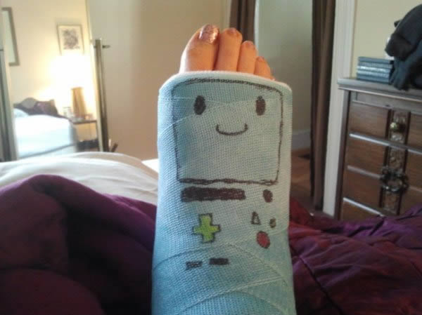 600x449 awesome cast designs - Leg Cast Drawing