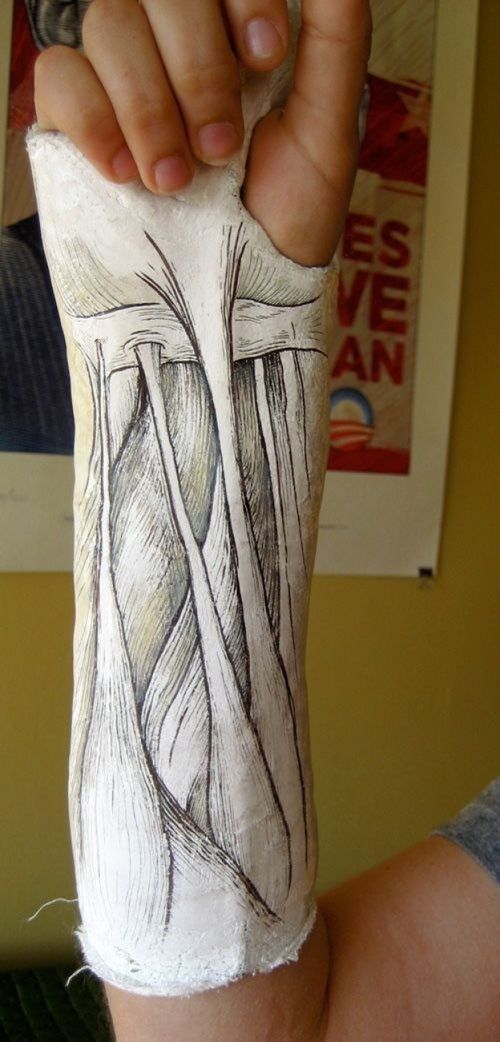 500x1042 nerd alert muscles of the anterior forearm awesome cast drawing - Leg Cast Drawing