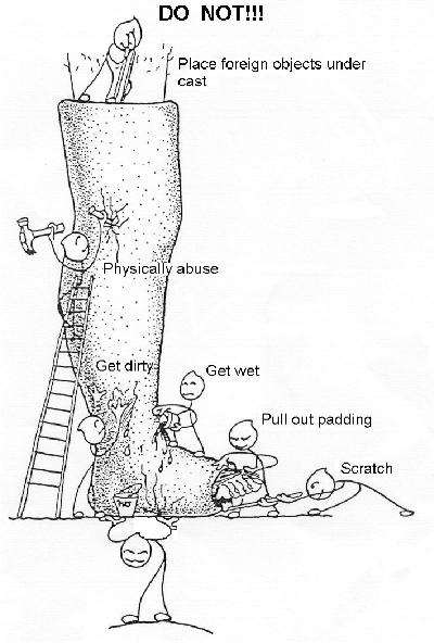 400x592 your child's leg plaster kidshealth - Leg Cast Drawing